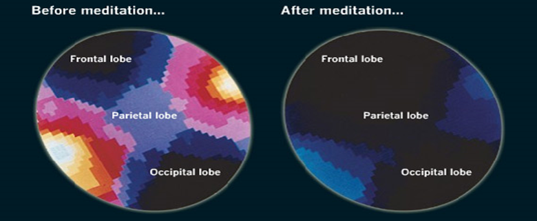 Inside of the brain before and after meditation